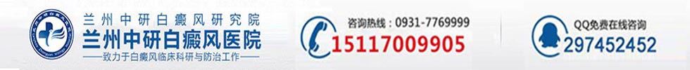 兰州中研白癜风院